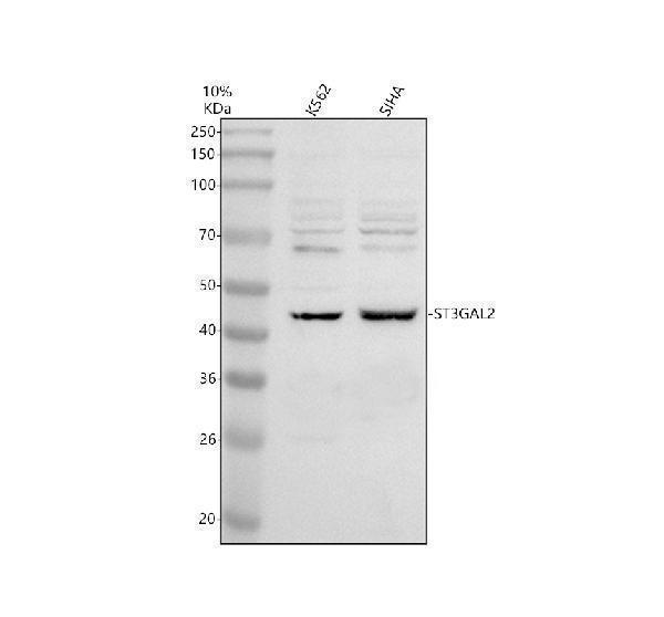 Western blot analysis of ST3GAL2 using anti-ST3GAL2 antibody (A10700-1)