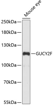 Western blot analysis of extracts of mouse eye, using GUCY2F antibody  at 1:1000 dilution