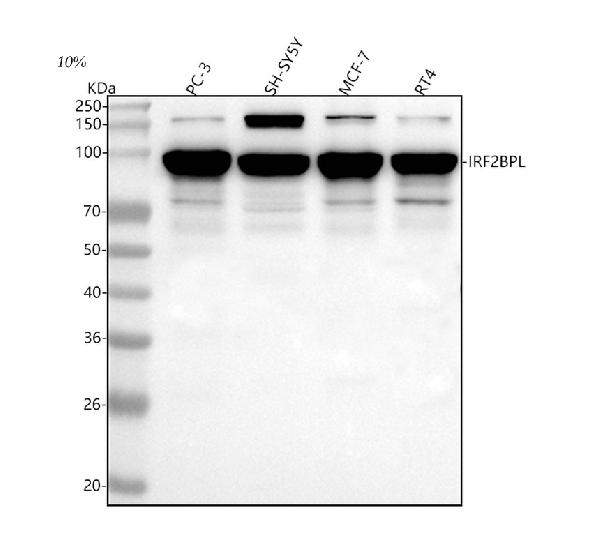 Figure 1. Western blot analysis of IRF2BPL using anti-IRF2BPL antibody (A10706). Electrophoresis was performed on a 5-20% SDS-PAGE gel at 70V (Stacking gel) / 90V (Resolving gel) for 2-3 hours. The sample well of each lane was loaded with 30 ug of sample under reducing conditions. Lane 1: human PC-3 whole cell lysates, Lane 2: human SH-SY5Y whole cell lysates, Lane 3: human MCF-7whole cell lysates, Lane 4: human RT4 whole cell lysates. After electrophoresis, proteins were transferred to a nitrocellulose membrane at 150 mA for 50-90 minutes. Blocked the membrane with 5% non-fat milk/TBS for 1.5 hour at RT. The membrane was incubated with rabbit anti-IRF2BPL antigen affinity purified polyclonal antibody (Catalog # A10706) at 0.25 microg/mL overnight at 4°C, then washed with TBS-0.1%Tween 3 times with 5 minutes each and probed with a goat anti-rabbit IgG-HRP secondary antibody at a dilution of 1:5000 for 1.5 hour at RT. The signal is developed using an Enhanced Chemiluminescent detection (ECL) kit (Catalog # EK1002) with Tanon 5200 system. A specific band was detected for IRF2BPL at approximately 95 kDa. The expected band size for IRF2BPL is at 83 kDa.