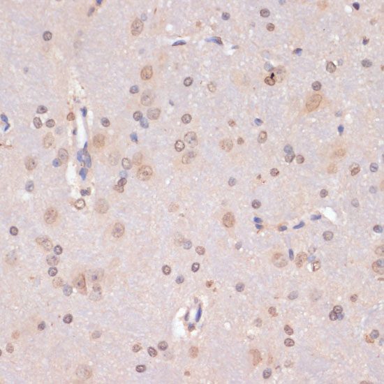 Immunohistochemistry of paraffin-embedded rat brain using PIDD antibody  at dilution of 1:100 