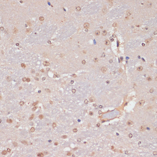 a10708 pidd1 primary antiboties ihc testing 4