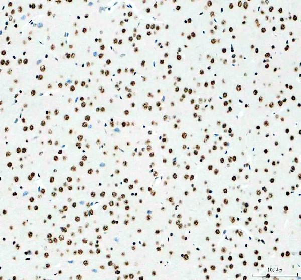 a10709 1 snrpb2 primary antibodies ihc testing 3