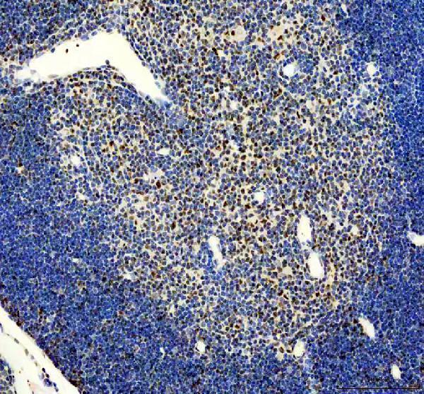a10709 1 snrpb2 primary antibodies ihc testing 4