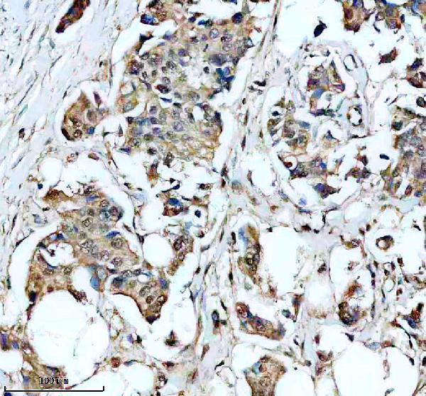 IHC analysis of DDX24 using anti-DDX24 antibody (A10710-2)