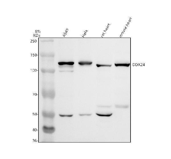 Western blot analysis of DDX24 using anti-DDX24 antibody (A10710-2)
