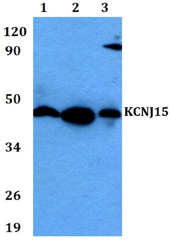 a10715 kcnj15 primary antiboties wb testing 1