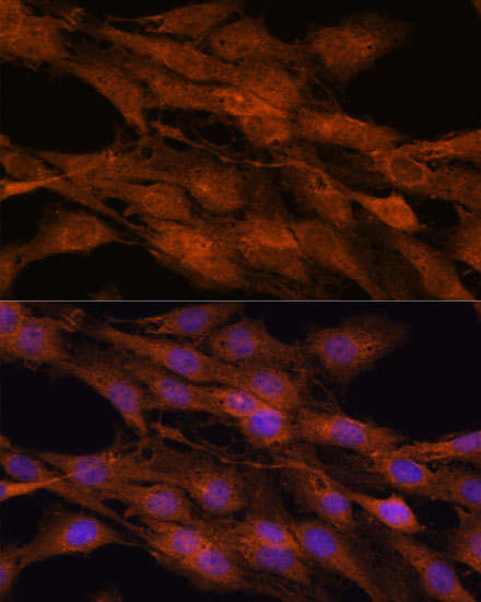 a10717 commd5 primary antiboties if testing 2