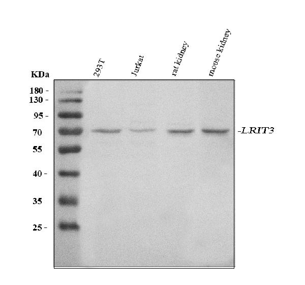 Figure 1. Western blot analysis of LRIT3 using anti-LRIT3 antibody (A10719-1). Electrophoresis was performed on a 5-20% SDS-PAGE gel at 70V (Stacking gel) / 90V (Resolving gel) for 2-3 hours. The sample well of each lane was loaded with 30 ug of sample under reducing conditions. Lane 1: human 293T whole cell lysates, Lane 2: human Jurkat whole cell lysates, Lane 3: rat kidney tissue lysates, Lane 4: mouse kidney tissue lysates. After electrophoresis, proteins were transferred to a nitrocellulose membrane at 150 mA for 50-90 minutes. Blocked the membrane with 5% non-fat milk/TBS for 1.5 hour at RT. The membrane was incubated with rabbit anti-LRIT3 antigen affinity purified polyclonal antibody (Catalog # A10719-1) at 0.5 microg/mL overnight at 4°C, then washed with TBS-0.1%Tween 3 times with 5 minutes each and probed with a goat anti-rabbit IgG-HRP secondary antibody at a dilution of 1:5000 for 1.5 hour at RT. The signal is developed using an Enhanced Chemiluminescent detection (ECL) kit (Catalog # EK1002) with Tanon 5200 system. A specific band was detected for LRIT3 at approximately 75 kDa. The expected band size for LRIT3 is at 75 kDa.