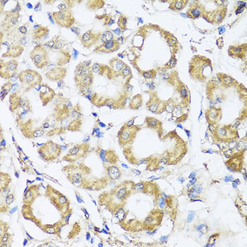 Immunohistochemistry of paraffin-embedded human stomach using B9D1 antibody  at dilution of 1:100 