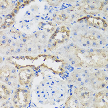 Immunohistochemistry of paraffin-embedded rat kidney using B9D1 antibody  at dilution of 1:100 