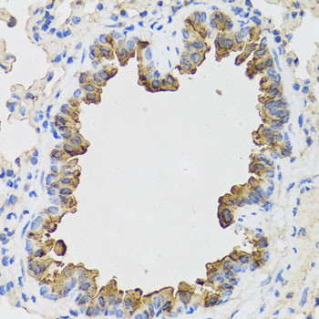a10722 1 b9d1 primary antiboties ihc testing 4