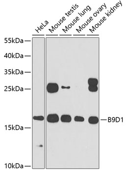 Western blot analysis of extracts of various cell lines, using B9D1 antibody  at 1:1000 dilution