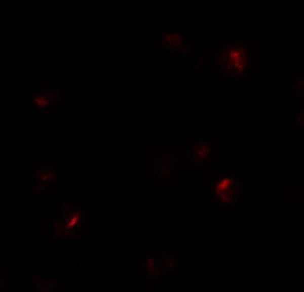 a10722 b9d1 primary antibodies if testing 3