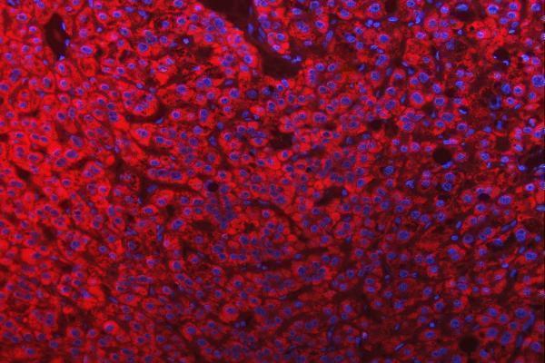 a10727 3 slc25a10 primary antibodies if testing 14