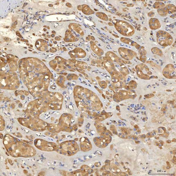 a10727 3 slc25a10 primary antibodies ihc testing 11
