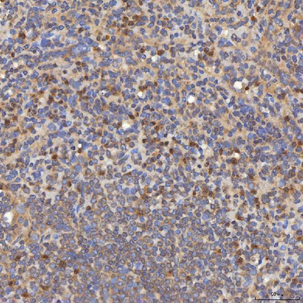 a10727 3 slc25a10 primary antibodies ihc testing 12