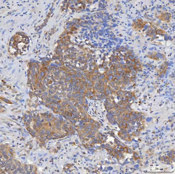 a10727 3 slc25a10 primary antibodies ihc testing 13