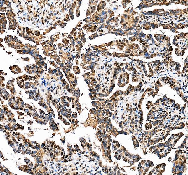 IHC analysis of DNAJC9 using anti-DNAJC9 antibody (A10730-2)