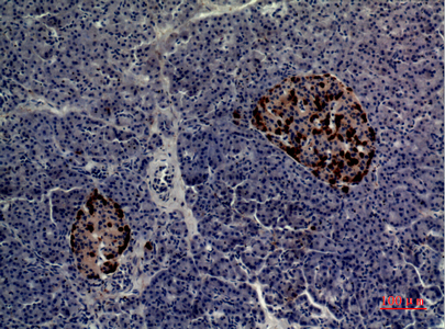 a10739 cmtm5 primary antibodies ihc testing 1