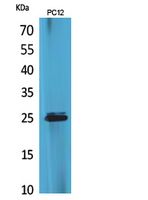 a10739 cmtm5 primary antibodies wb testing 2