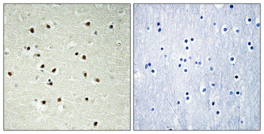 Immunohistochemical analysis of paraffin-embedded Human brain