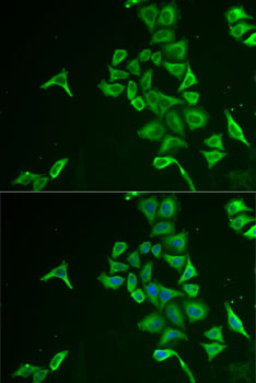 Immunofluorescence analysis of U2OS cells using INPP5J antibody 