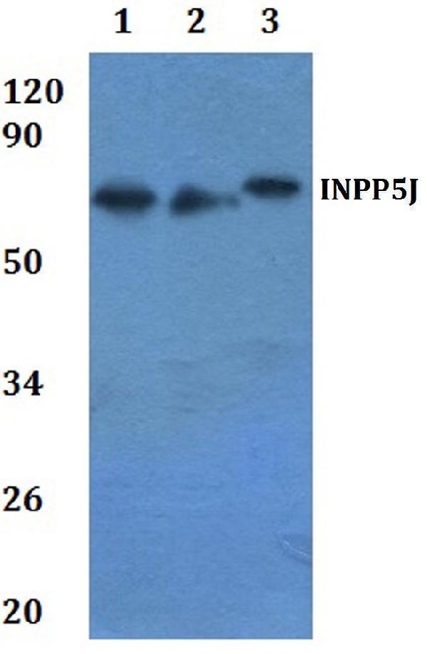 a10752 inpp5j primary antiboties wb testing 1