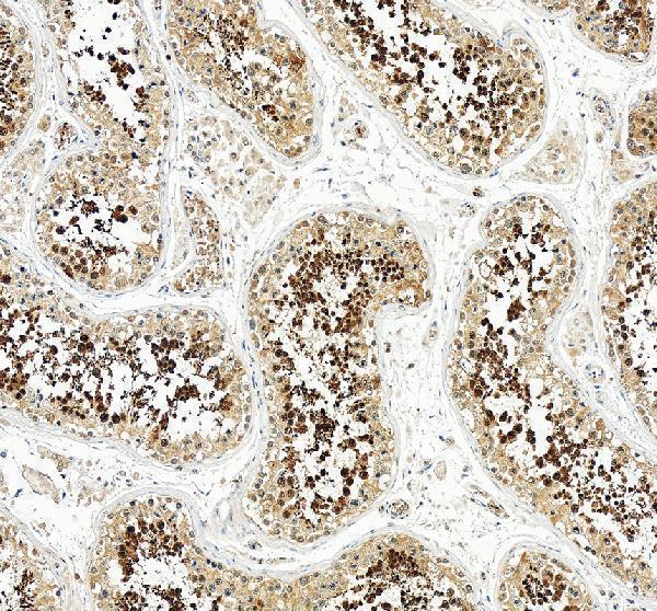 IHC analysis of HSPA4L using anti-HSPA4L antibody (A10753-1)