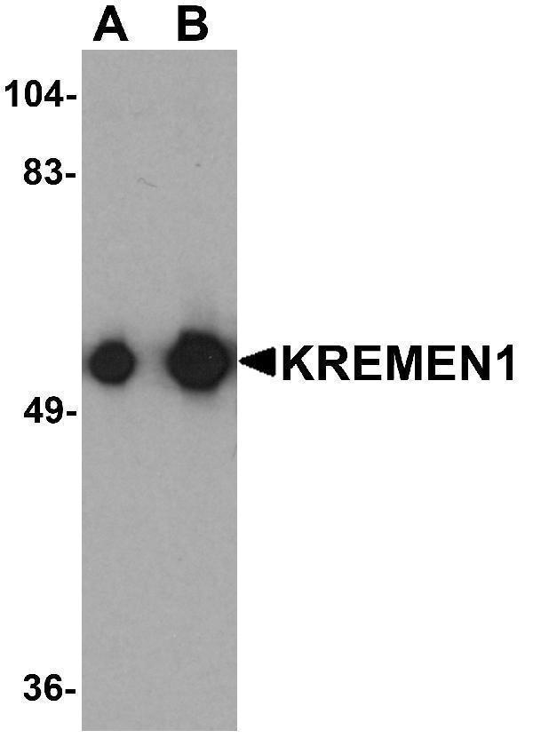 Western blot analysis of KREMEN1 in rat small intestine tissue lysate with KREMEN1 antibody at (A) 0