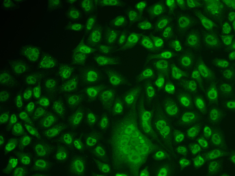 Immunofluorescence analysis of U2OS cells using TFPT antibody 