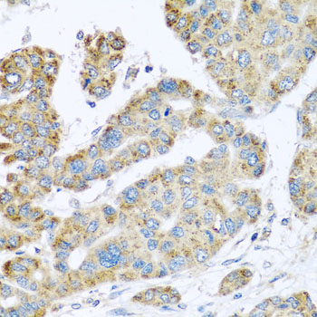 Immunohistochemistry of paraffin-embedded human stomach using SYT4 antibody at dilution of 1:100 (x40 lens)