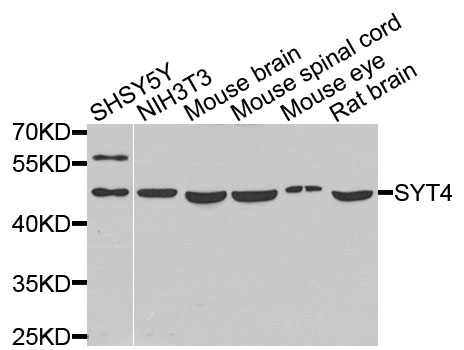 Western blot analysis of extracts of various cells, using SYT4 antibody