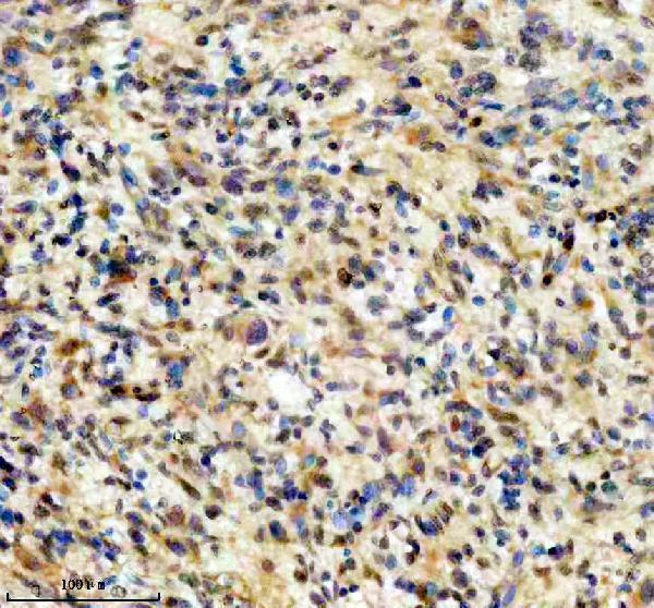 IHC analysis of GRID1 using anti-GRID1 antibody (A10763-1)