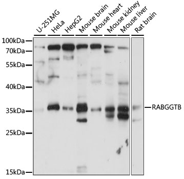 Western blot analysis of extracts of various cell lines, using RABGGTB antibody  at 1:1000 dilution