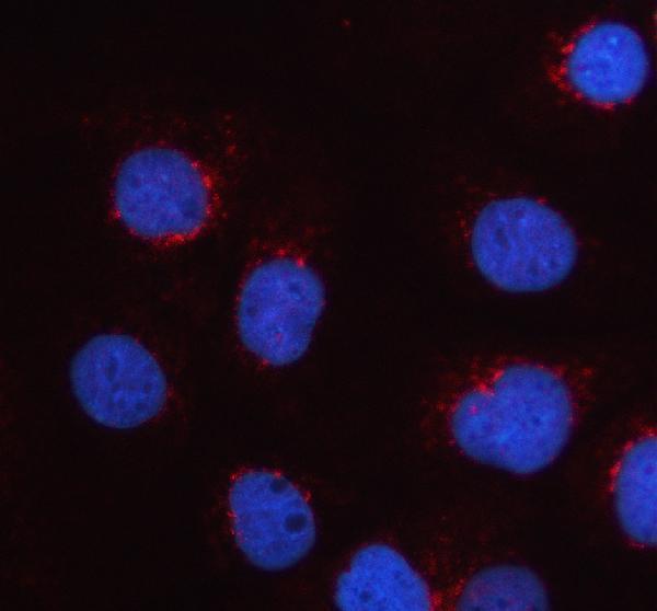 a10772 1 galnt6 primary antibodies if testing 1
