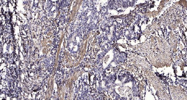a10773 pik3c2g primary antibodies ihc testing 1