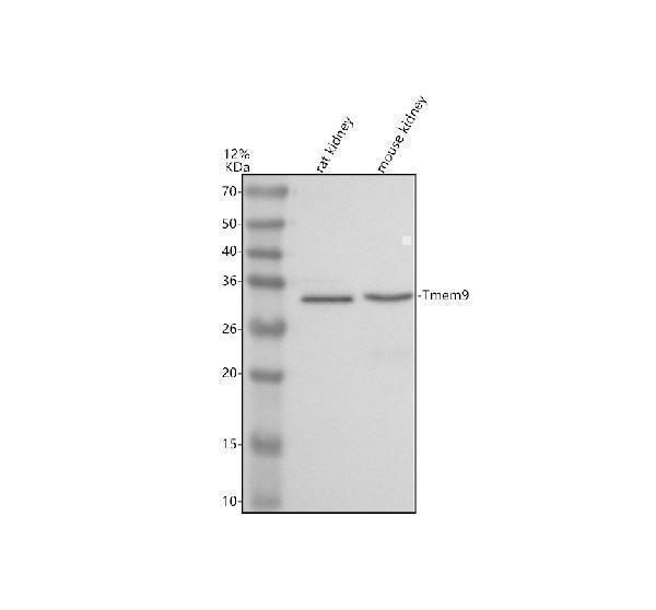 Western blot analysis of TMEM9 using anti-TMEM9 antibody (A10779-1)