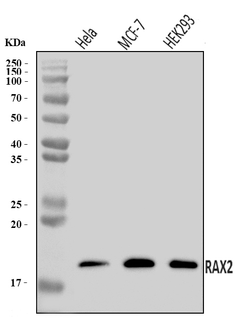 Figure 1. Western blot analysis of RAX2 using anti-RAX2 antibody (A10782-1). Electrophoresis was performed on a 5-20% SDS-PAGE gel at 70V (Stacking gel) / 90V (Resolving gel) for 2-3 hours. The sample well of each lane was loaded with 30 ug of sample under reducing conditions. Lane 1: human Hela whole cell lysates, Lane 2: human MCF-7 whole cell lysates, Lane 3: human HEK293 whole cell lysates. After electrophoresis, proteins were transferred to a nitrocellulose membrane at 150 mA for 50-90 minutes. Blocked the membrane with 5% non-fat milk/TBS for 1.5 hour at RT. The membrane was incubated with rabbit anti-RAX2 antigen affinity purified polyclonal antibody (Catalog # A10782-1) at 0.25 microg/mL overnight at 4°C, then washed with TBS-0.1%Tween 3 times with 5 minutes each and probed with a goat anti-rabbit IgG-HRP secondary antibody at a dilution of 1:5000 for 1.5 hour at RT. The signal is developed using an Enhanced Chemiluminescent detection (ECL) kit (Catalog # EK1002) with Tanon 5200 system. A specific band was detected for RAX2 at approximately 18 kDa. The expected band size for RAX2 is at 20 kDa.