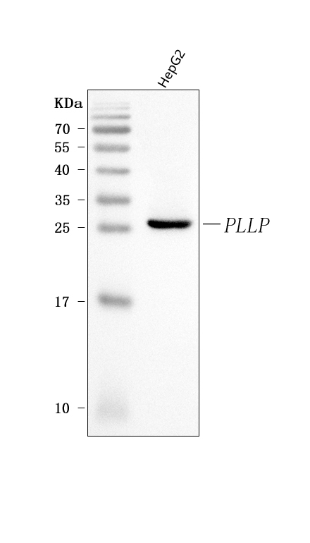 Figure 1. Western blot analysis of Plasmolipin/PLLP using anti-Plasmolipin/PLLP antibody (A10793). Electrophoresis was performed on a 5-20% SDS-PAGE gel at 70V (Stacking gel) / 90V (Resolving gel) for 2-3 hours. The sample well of each lane was loaded with 30 ug of sample under reducing conditions. Lane 1: human HepG2 whole cell lysates. After electrophoresis, proteins were transferred to a nitrocellulose membrane at 150 mA for 50-90 minutes. Blocked the membrane with 5% non-fat milk/TBS for 1.5 hour at RT. The membrane was incubated with rabbit anti-Plasmolipin/PLLP antigen affinity purified polyclonal antibody (Catalog # A10793) at 0.5 microg/mL overnight at 4°C, then washed with TBS-0.1%Tween 3 times with 5 minutes each and probed with a goat anti-rabbit IgG-HRP secondary antibody at a dilution of 1:5000 for 1.5 hour at RT. The signal is developed using an Enhanced Chemiluminescent detection (ECL) kit (Catalog # EK1002) with Tanon 5200 system. A specific band was detected for Plasmolipin/PLLP at approximately 26 kDa. The expected band size for Plasmolipin/PLLP is at 18,20 kDa.