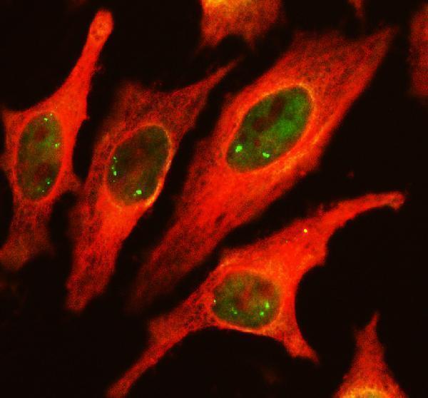 a10794 1 evx1 primary antibodies if testing 1