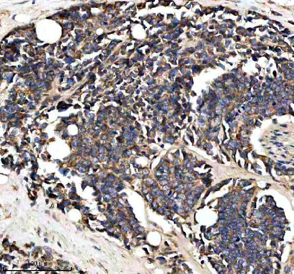  IHC analysis of PTCD3 using anti-PTCD3 antibody (A10795-1)