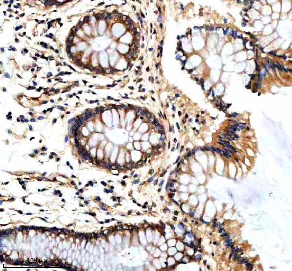  IHC analysis of PTCD3 using anti-PTCD3 antibody (A10795-1)