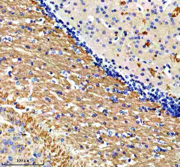 a10795 1 ptcd3 primary antibodies ihc testing 4