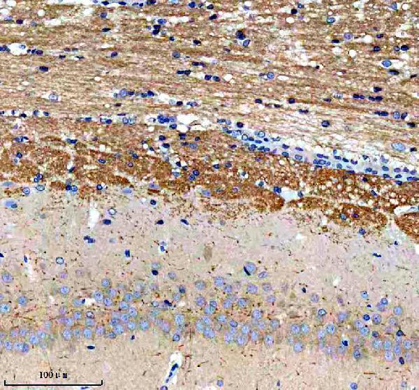 a10795 1 ptcd3 primary antibodies ihc testing 5