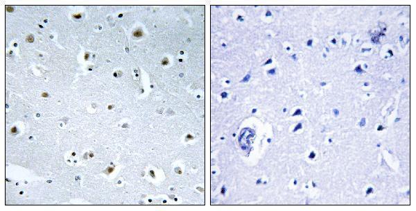 a10799 tubgcp3 primary antibodies ihc testing 1
