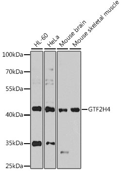 a10801 gtf2h4 primary antiboties wb testing 1