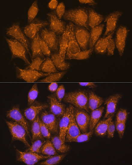 Immunofluorescence analysis of HeLa cells using ATP6V1E1 Rabbit pAb  at dilution of 1:100
