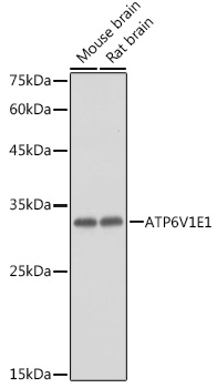 Western blot analysis of extracts of various cell lines, using ATP6V1E1 antibody  at 1:1000 dilution