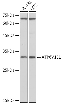 Western blot analysis of extracts of various cell lines, using ATP6V1E1 antibody  at 1:1000 dilution