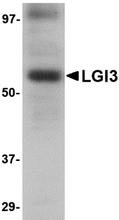 Western blot analysis of LGI3 in human brain tissue lysate with LGI3 antibody at 1 μg/mL